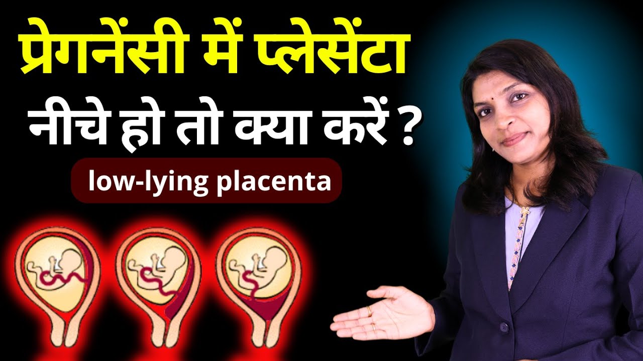 Low lying placenta हो तो गर्भवती क्या करें? #lowlyingplacenta