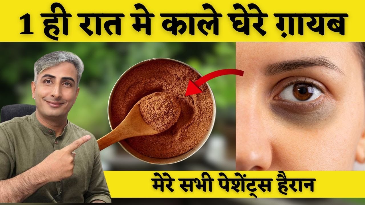 1 ही रात मे आंखों के काले घेरे हटाने के घरेलू नुस्खे   Dark Circles Kaise Hataye I DR, MANOJ DAS