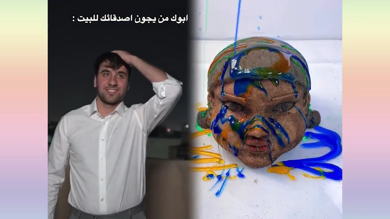 #الطفل الاعمى المعجزه #محضوره_من_الاكسبلور_والمشاهدات #علاوي_مارتن #اكسبلور 15_w