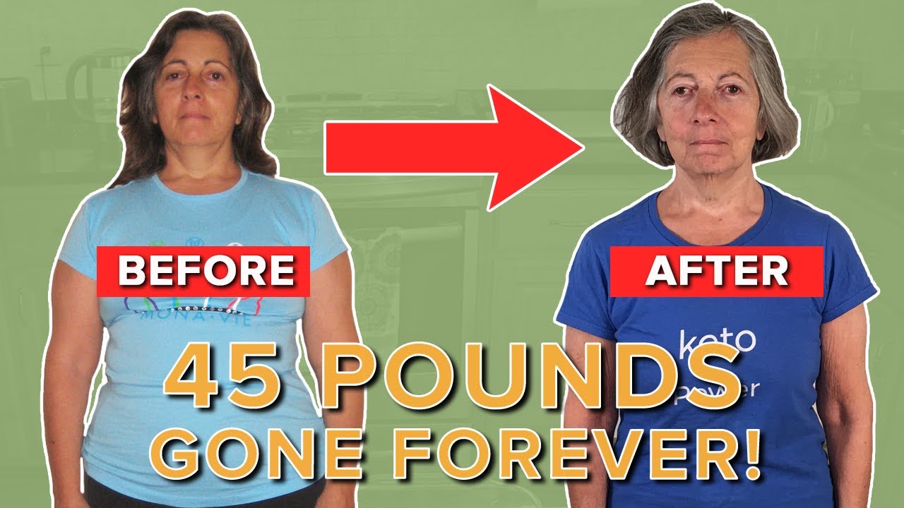 From Brain Tumor to Keto to Fasting to Carnivore to Precision PSMF- 45 Pounds Gone Forever!