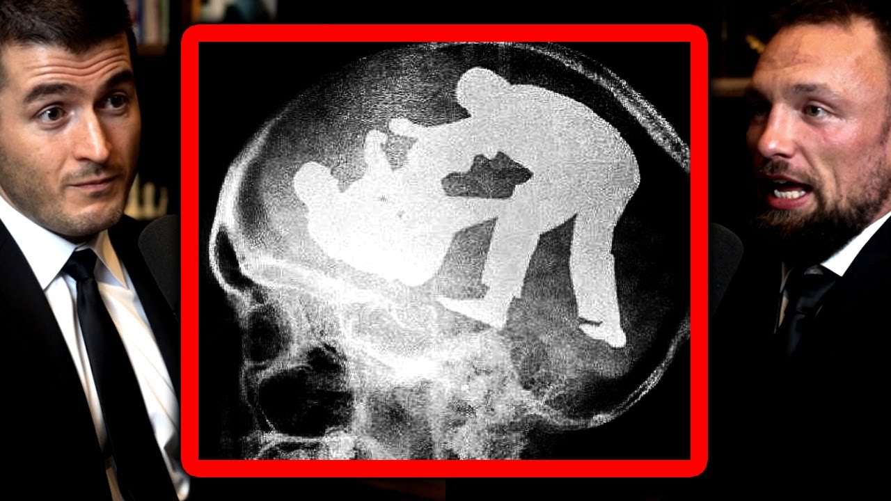 Psychology of competition in jiu jitsu | Craig Jones and Lex Fridman
