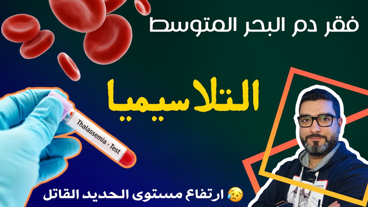 أخطر مرض يسبب فقر الدم | التلاسيميا و نقص الحديد المميت