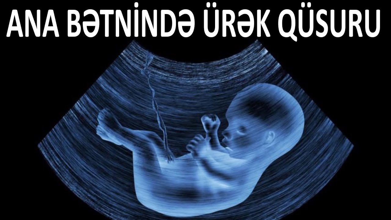 Döldə ürək qüsuru nədən yaranır? - Həkim açıqladı