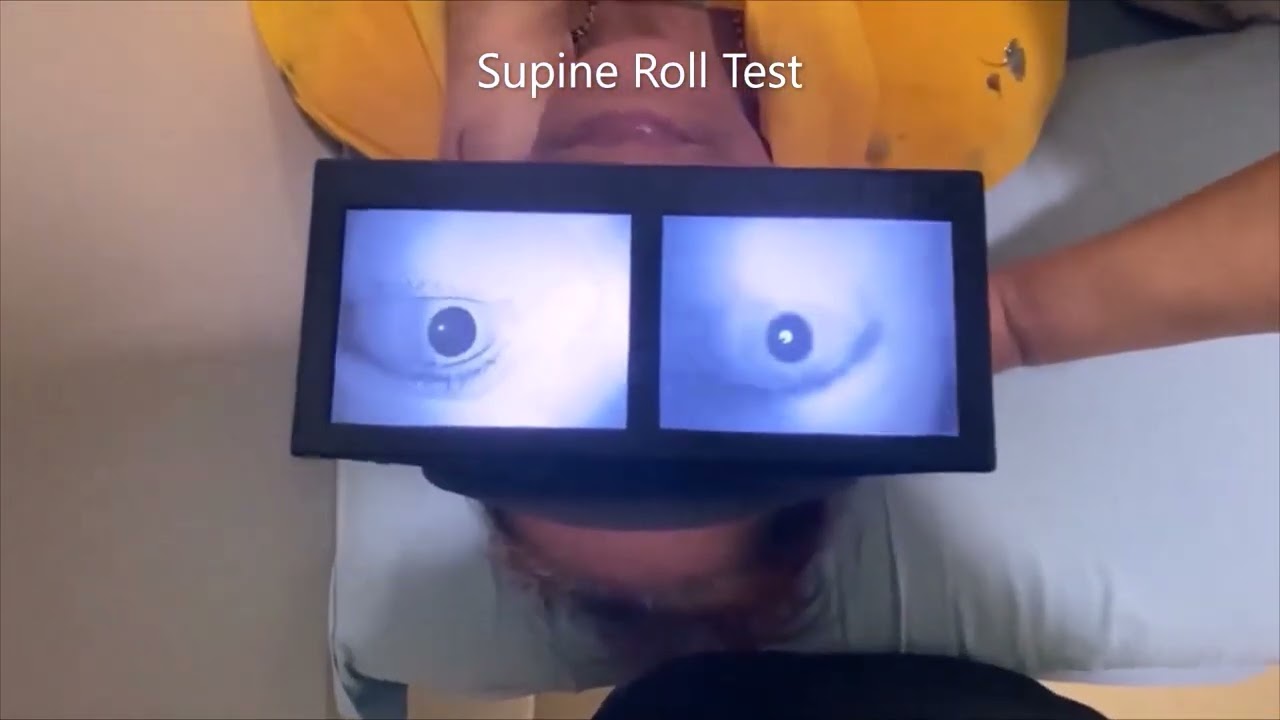 Central Persistent Direction-Changing Apogeotropic Positional Nystagmus