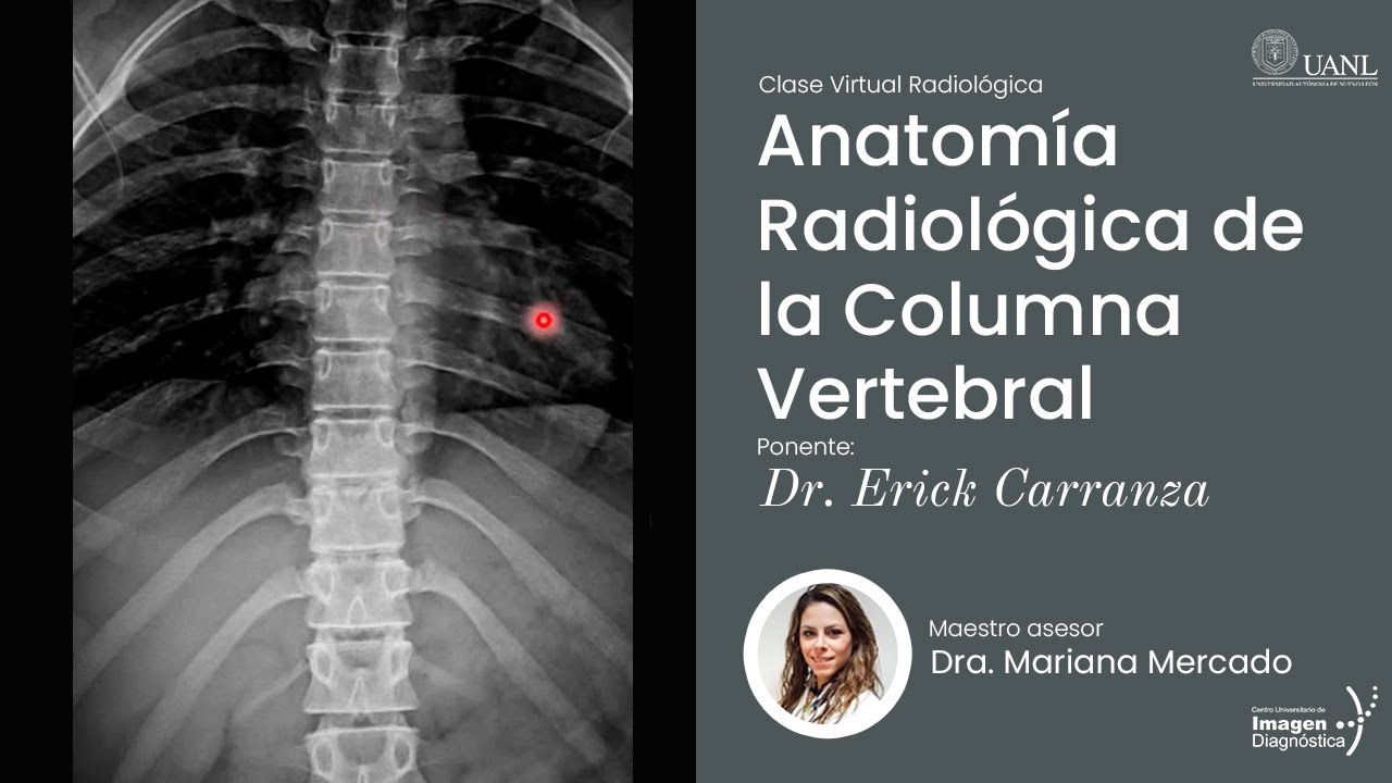 Anatomía Radiológica de la Columna Vertebral