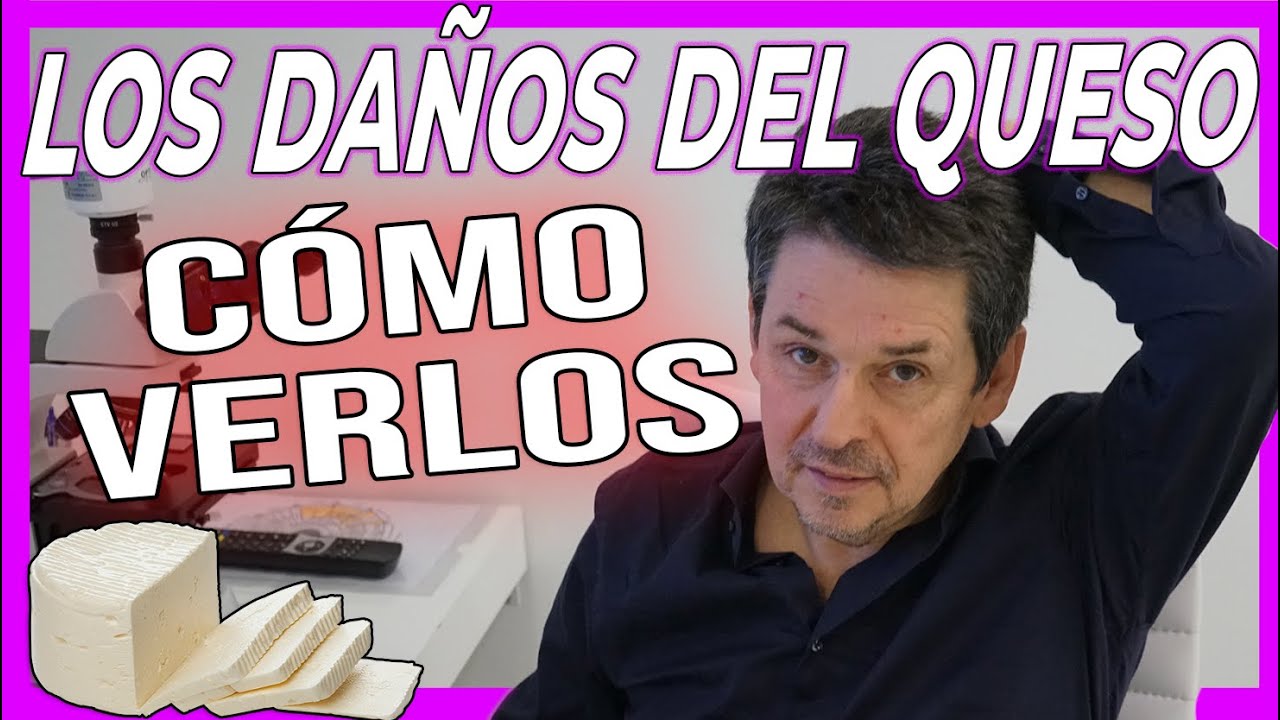 Así Puedes DETECTAR los DAÑOS que PRODUCE el QUESO. ¿Cómo puedes COMPROBAR que el queso te daña?