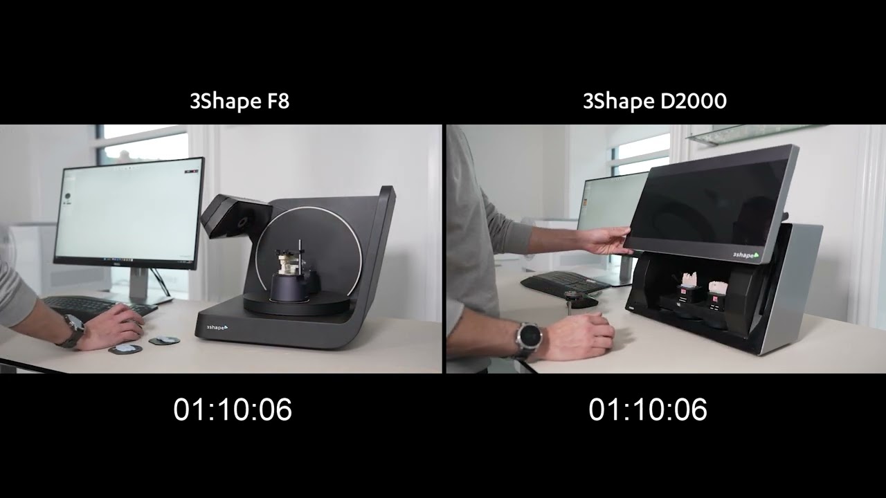 Speed Competition: 3Shape F8 vs D2000