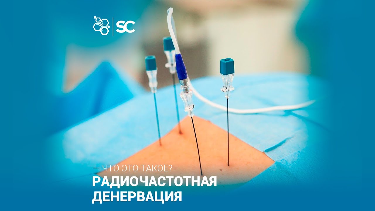 Радиочастотная денервация. — Что это такое?