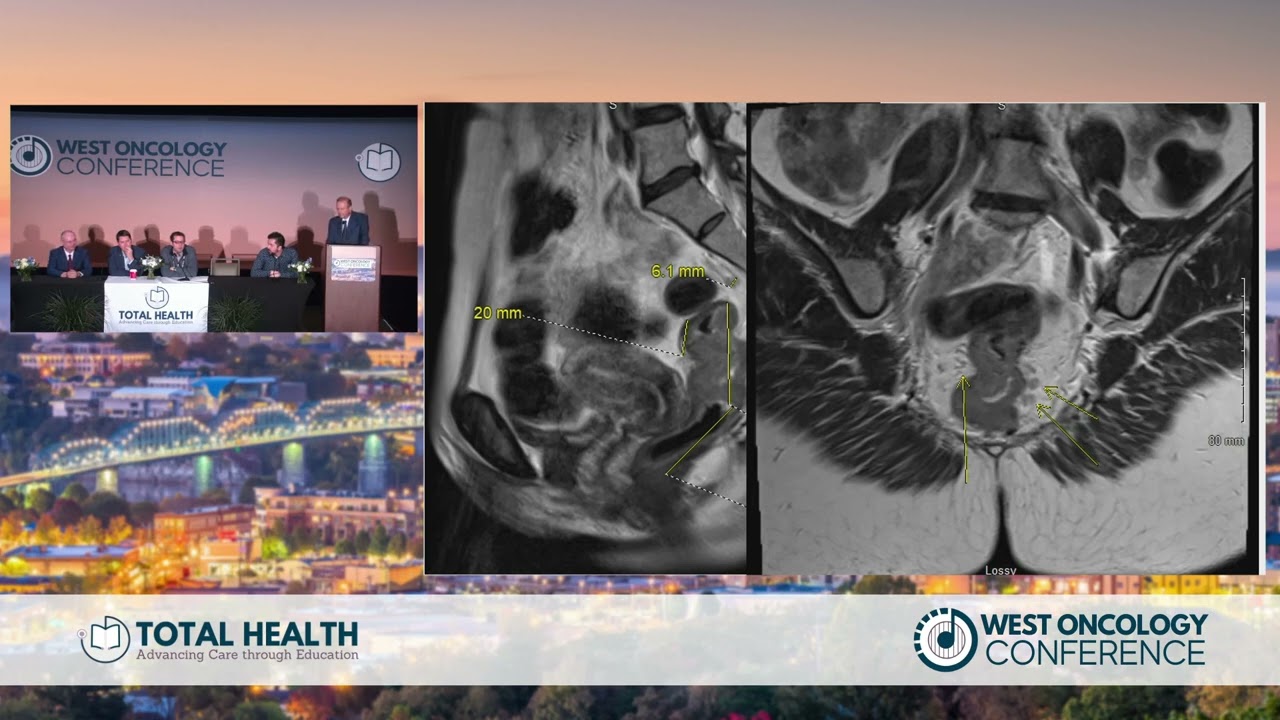 Day 1 | Panel Discussion and Q&A   Gastrointestinal Cancer