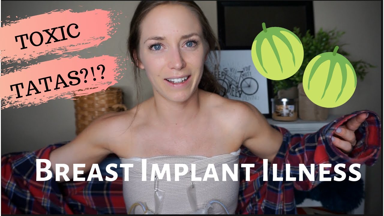 My (personal) Breast Implant Illness Experience (BII) | Symptoms, Timeline, Pictures & Explanting