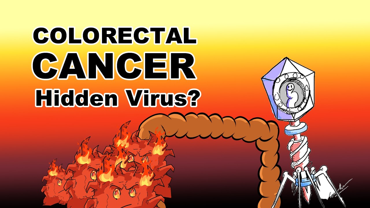 Colorectal Cancer: Did They Just Find the Real Trigger?