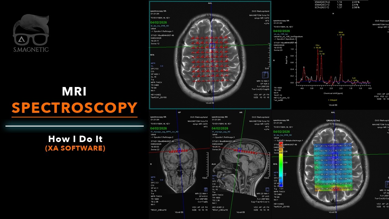 MRI SPECTROSCOPY – HOW I DO IT (XA SOFTWARE)