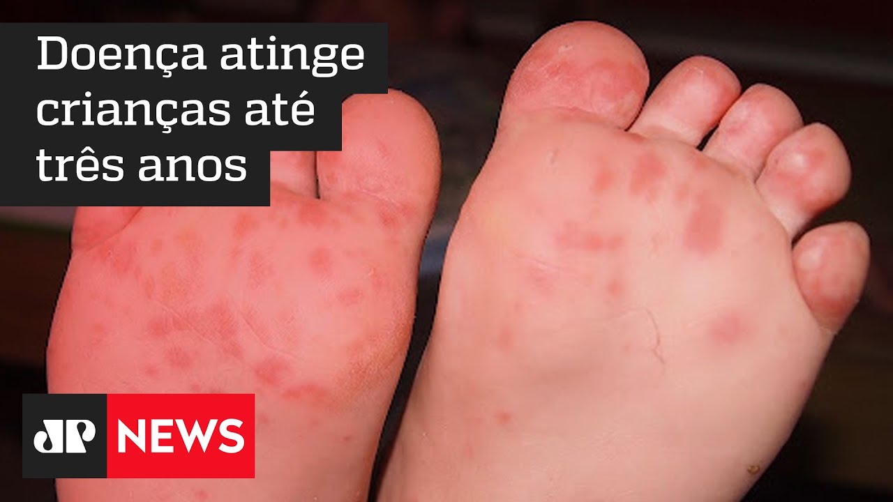 Virose conhecida como 