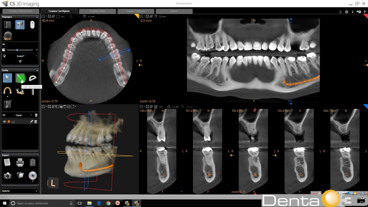 CS 3D Imaging - Prise en main globale