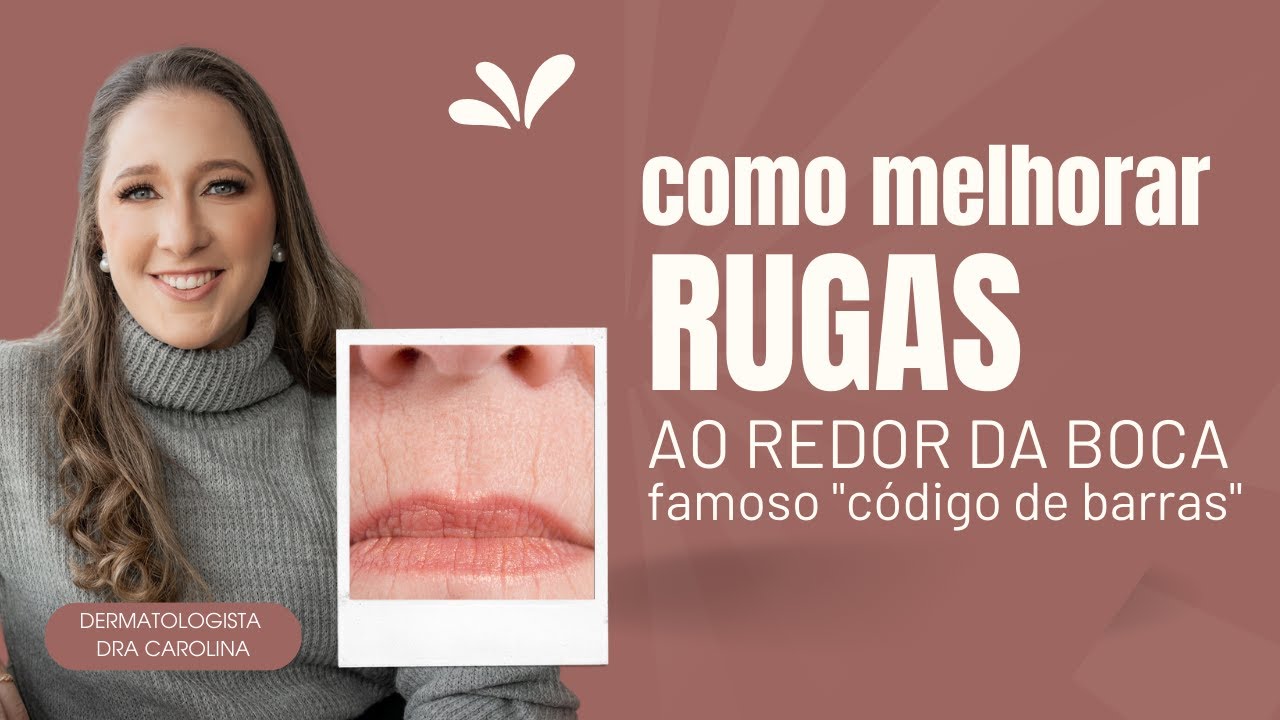 MELHORES TRATAMENTOS PARA RUGAS AO REDOR DA BOCA - DERMATO DRA CAROLINA