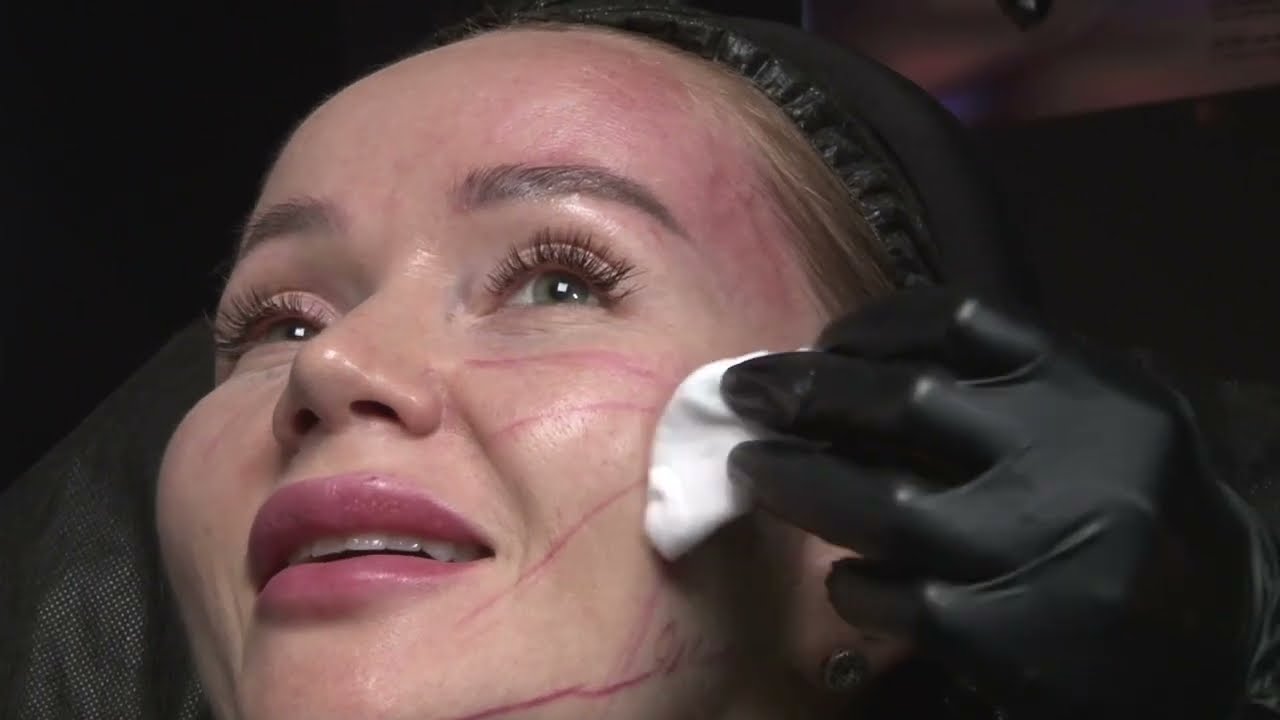 28 11 2023 GOURI Karisma LIVE INJECTION DEMONSTRATION Model 1