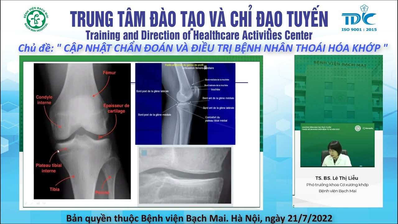 Cập nhật chẩn đoán và điều trị bệnh nhân thoái hóa khớp