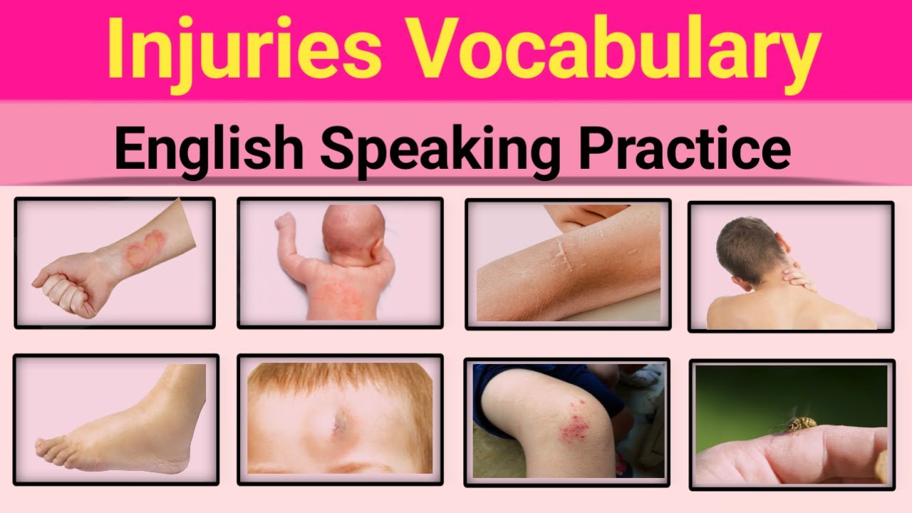 Injuries  Vocabulary Words with Their Urdu Meaning | top 16 injuries words