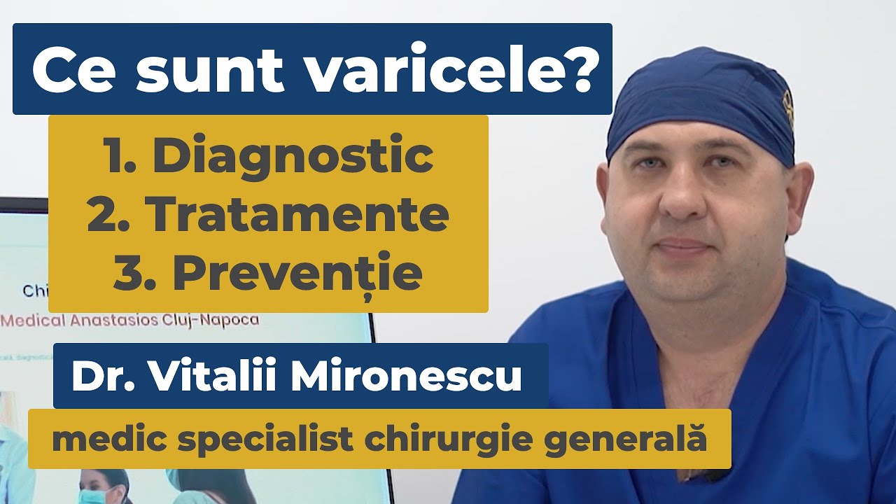 Ce sunt și cum tratăm varicele?