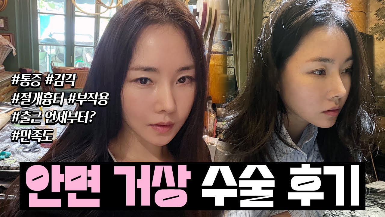 40대 안면거상술 2개월차 솔직 후기!! (통증, 감각, 흉터, 붓기 등)