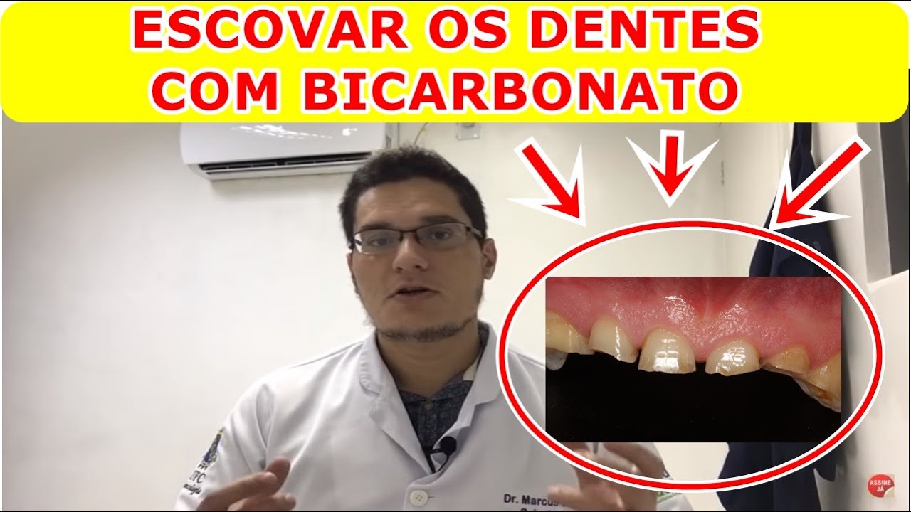 Escovar os Dentes com Bicarbonato é bom mesmo?