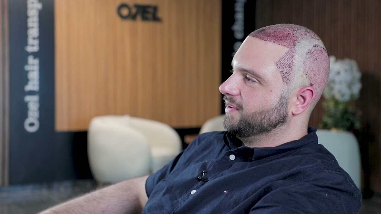 Best hair transplant in turkey 2024 review Ozel hair transplant