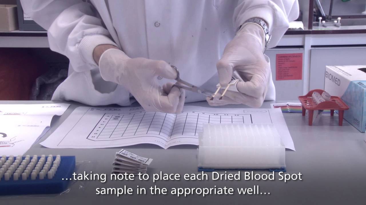 High-Throughput LAMP kit procedure