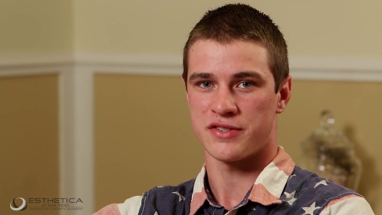 Devin Otoplasty Procedure