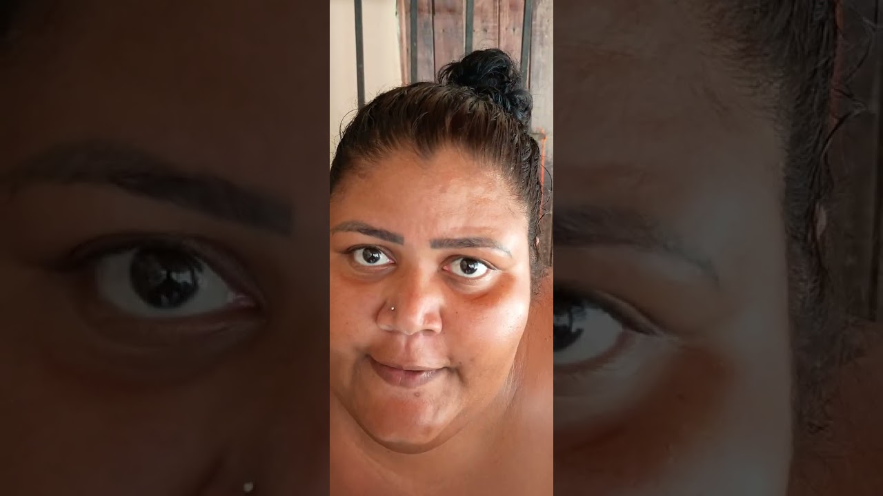 A vida de uma bariátricada