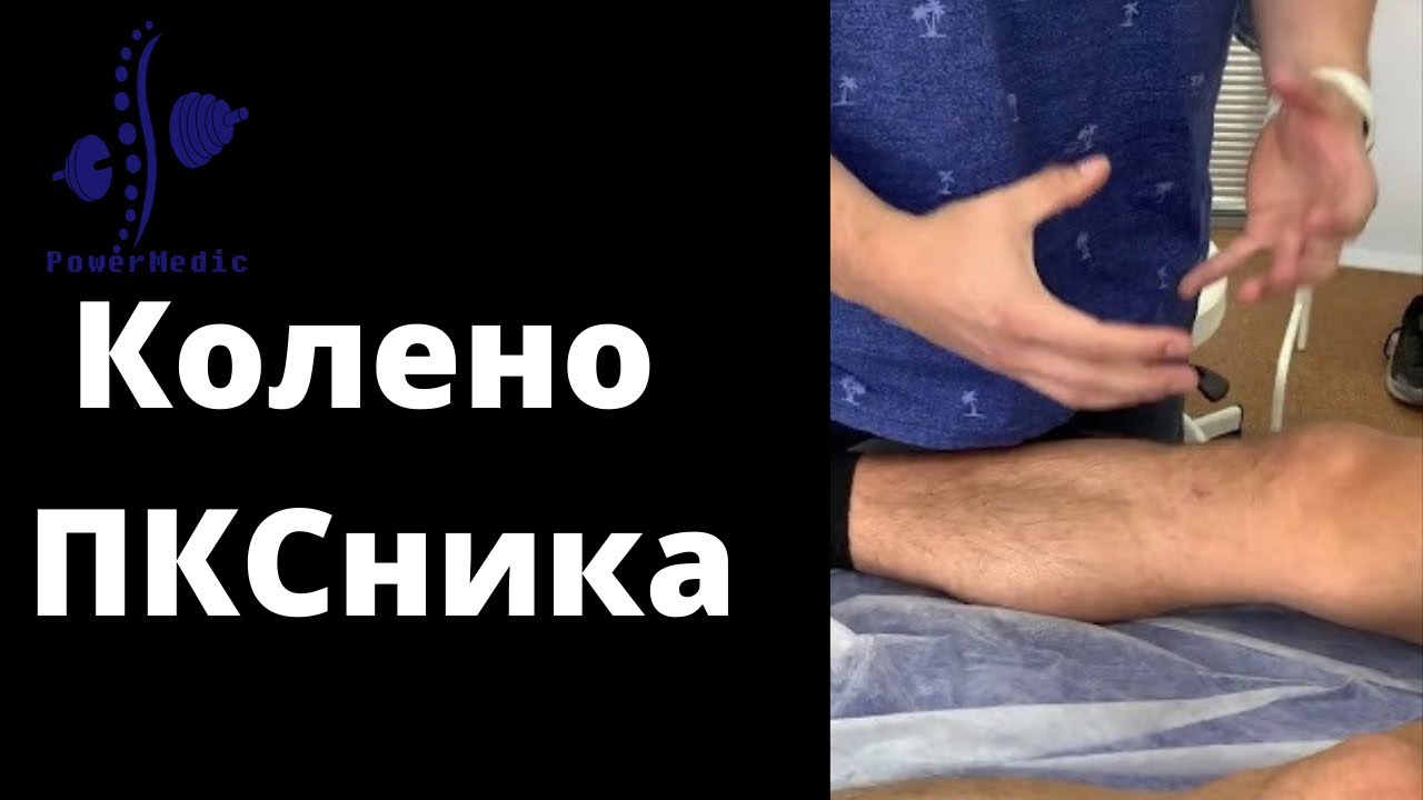 СОСТОЯНИЕ ПОСЛЕ ПЛАСТИКИ ПКС | Частые Проблемы