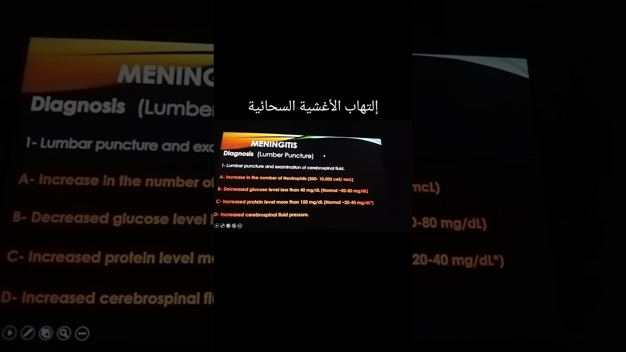 الباب التاسع (الفصل الثاني) إلتهاب الأغشية السحائية Meningitis 