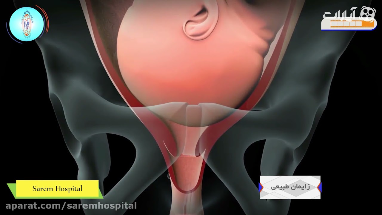 زایمان طبیعی چگونه اتفاق می افتد؟خانمها حتما ببینند
