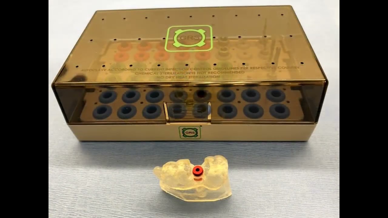 GRS Guide System   3D Printed Dental Implant Surgical Guide & Model