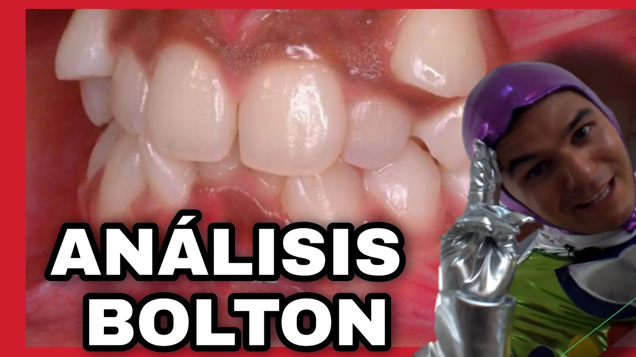 Análisis de Bolton