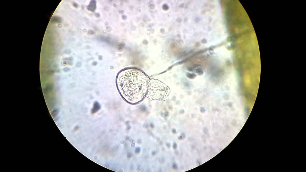 Dividing vorticella / Wirczyk - podział kom&oacute;rki