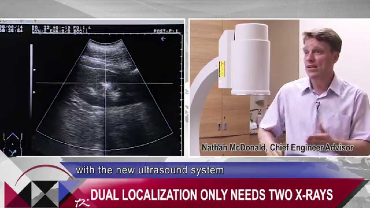 The First Auto Tracking & Locking ESWL (Lithotripsy) in The World | Unison Healthcare Group友信醫療集團