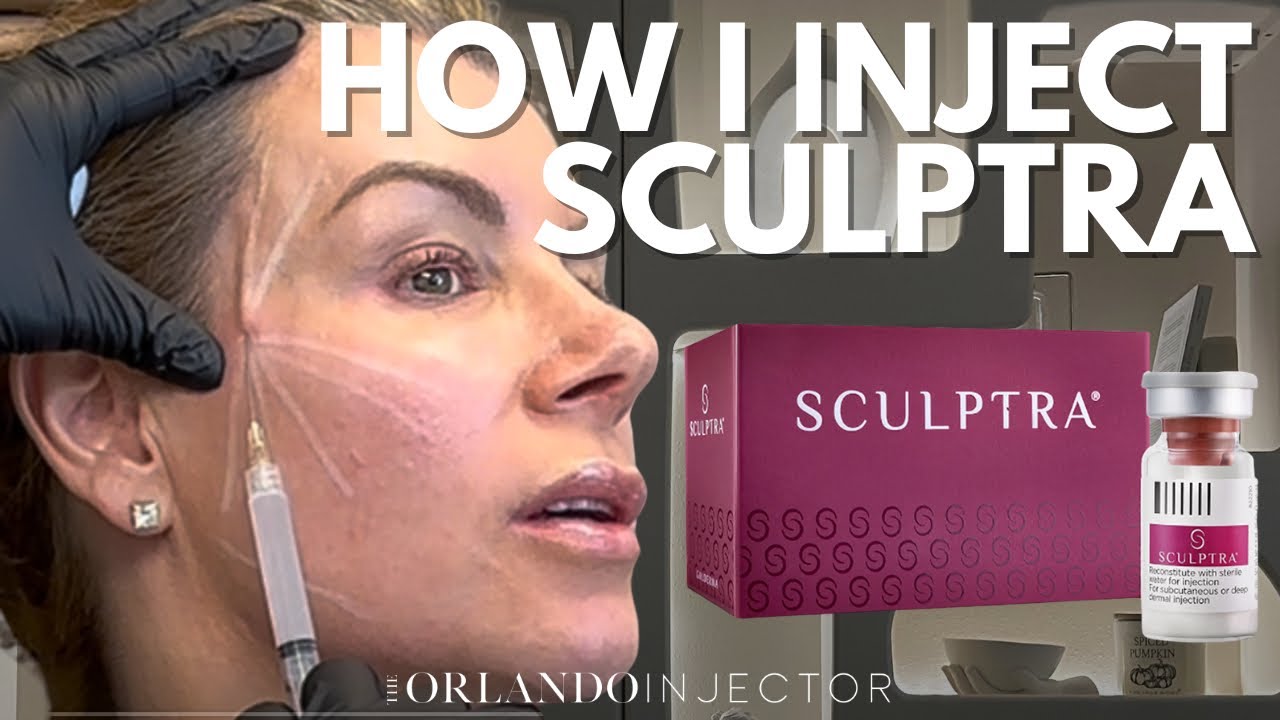 HOW I INJECT SCULPTRA