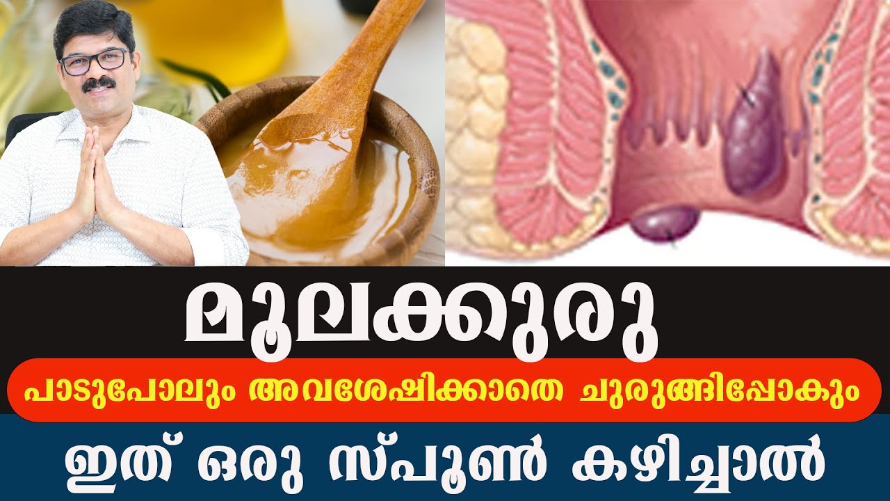 മലബന്ധം മാറാനും,മൂലക്കുരുവും ഫിസ്റ്റുലയും വീണ്ടും വരാത്ത രീതിയിൽ മാറാനും ഇത് ഒരു സ്പൂൺ കഴിച്ചാൽ മതി