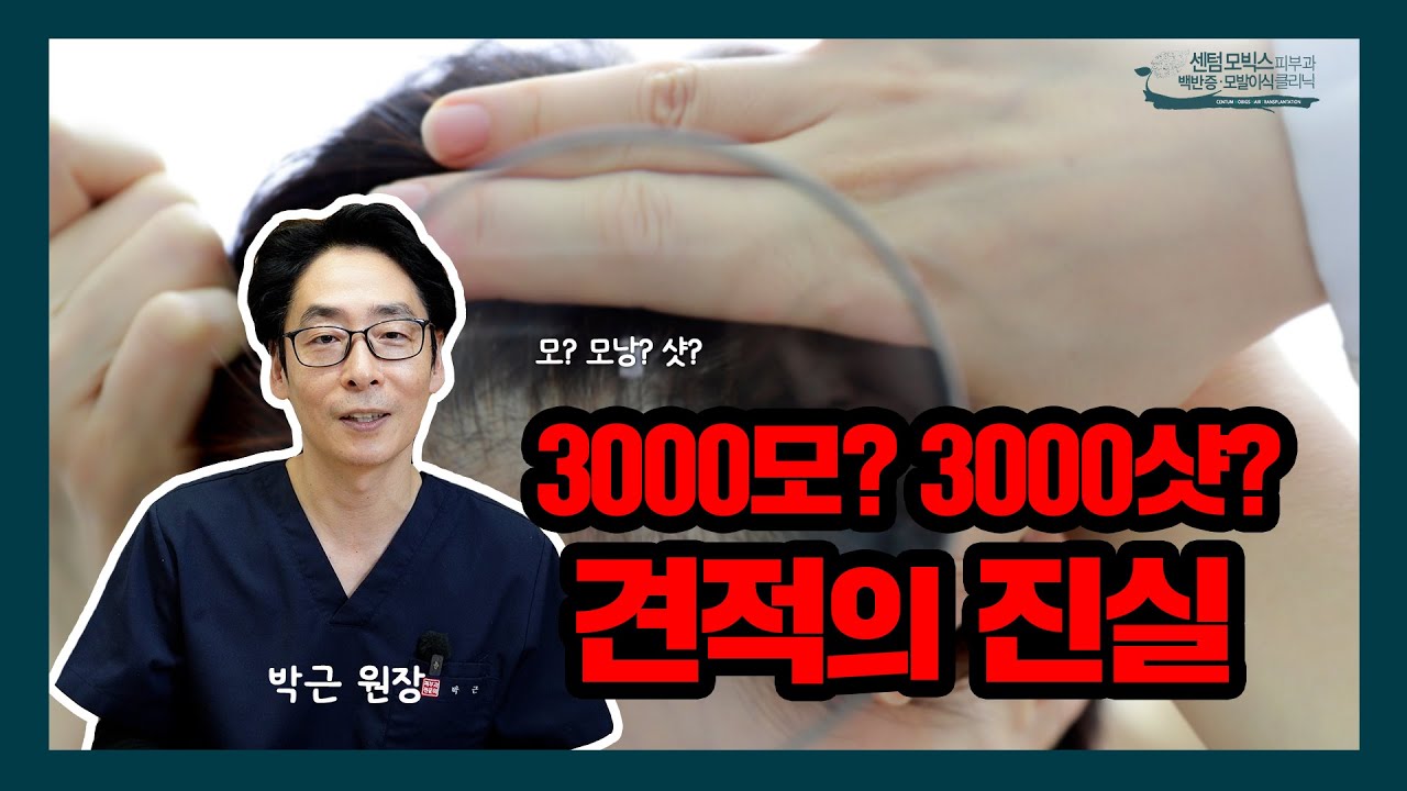 [모발이식] 3000모? 3000샷? 견적의 진실