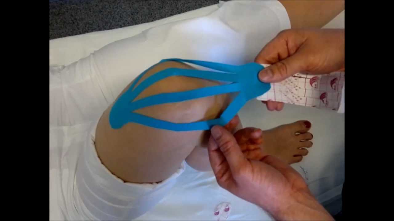 Tejpování kolene - kinesiotaping