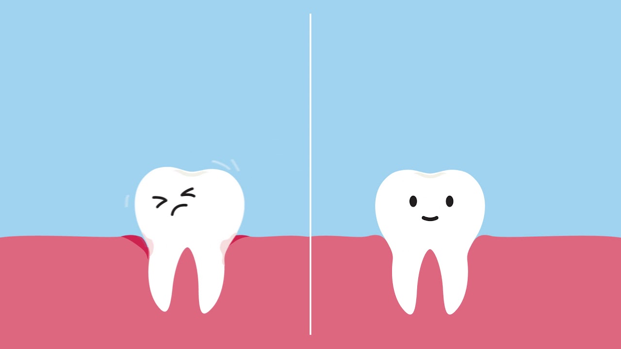 A Tale of Two Teeth