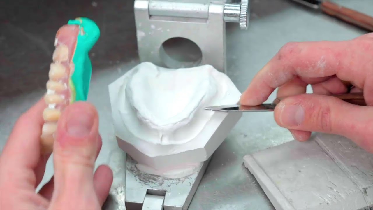 EASY INDIRECT TECHNIQUE - How to Use Kettenbach's Mucopren&reg; Soft #DentureReliner #Simple #Reliable