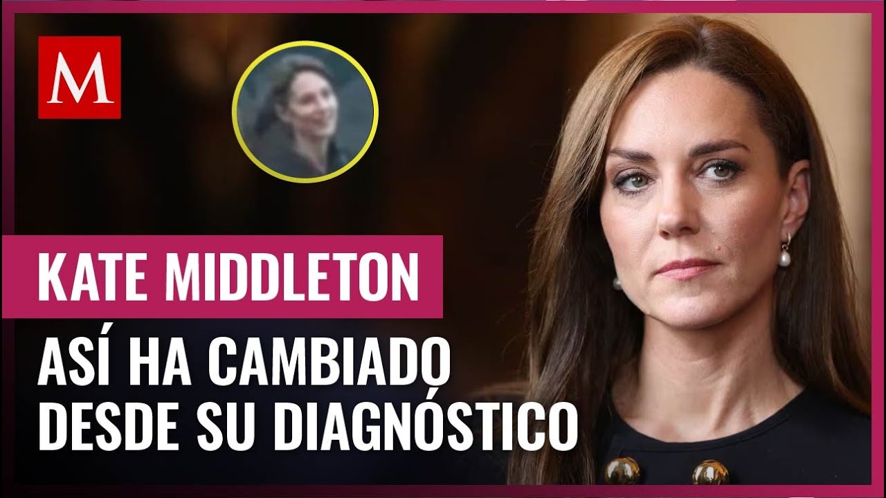 La princesa de Gales ha sufrido drásticos cambios luego de su diagnóstico de cáncer