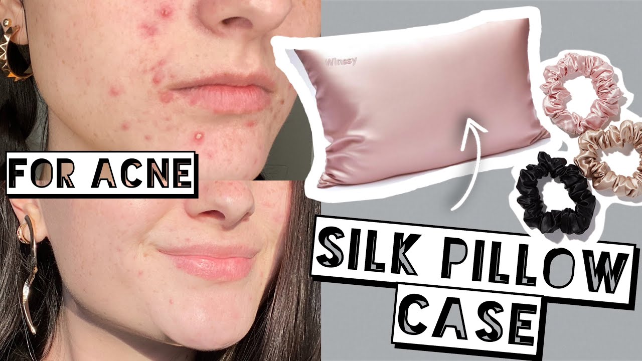 Switching to a Silk Pillow Case for My Acne, Skin, & Hair | Winssy Silk Products Review