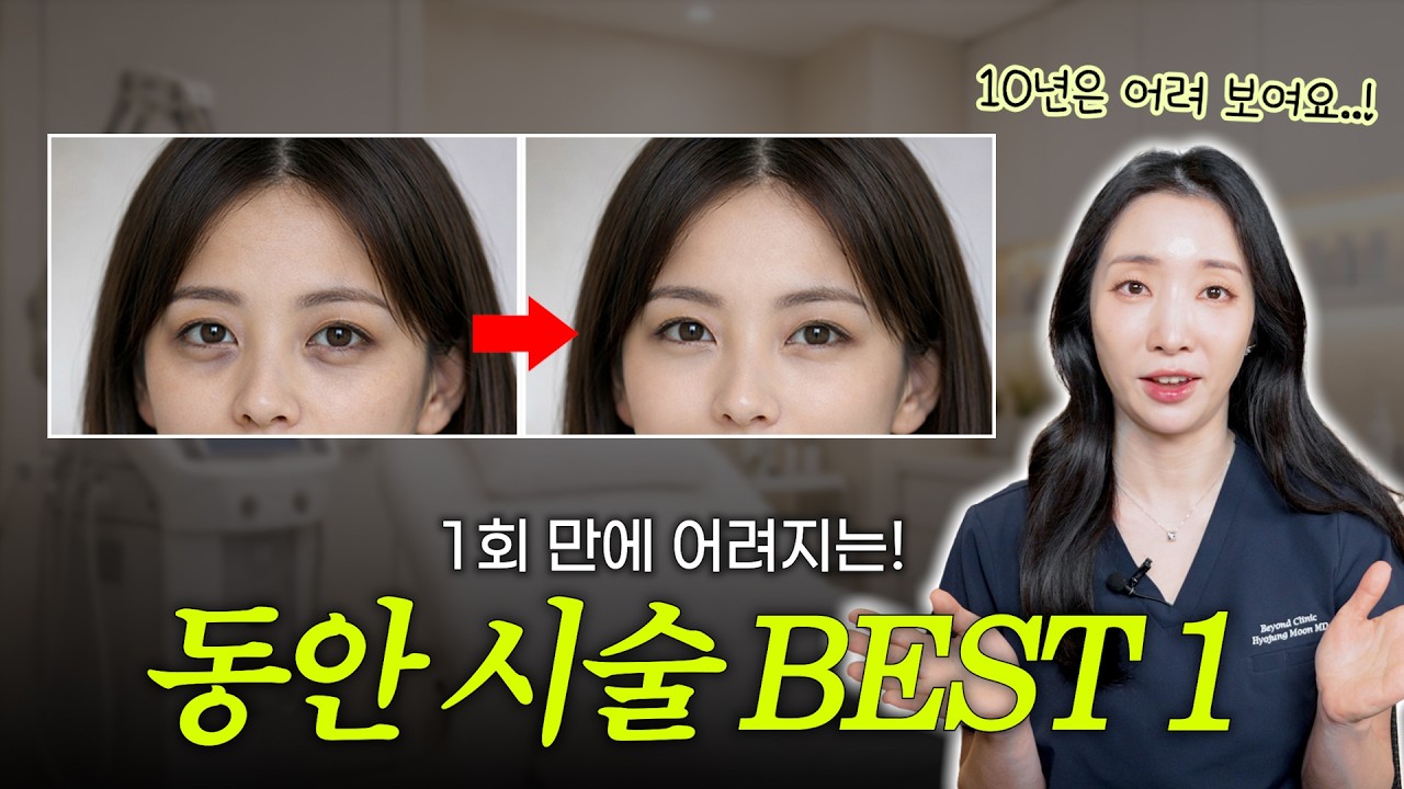 눈밑꺼짐 다크서클 좋아지는법!! 칙칙한 눈 밑 절대 방치 하지 마세요!