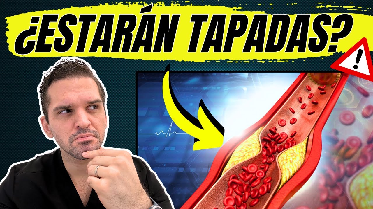 Como SABER si tus arterias del CORAZÓN están OBSTRUIDAS ✅