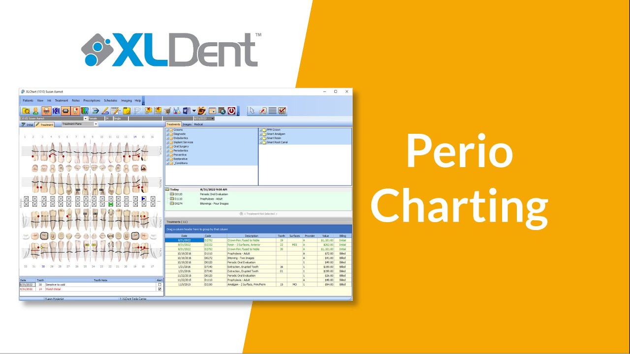 XLDent Dental Software Demo - Perio Charting