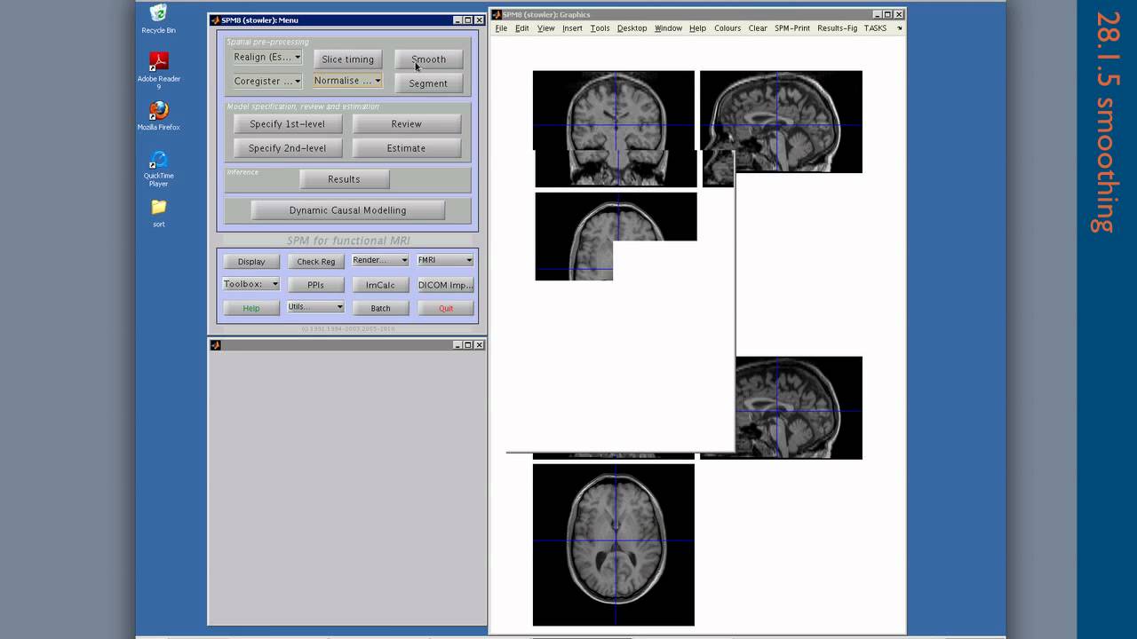 Test: SPM8 tutorial (MoAE)