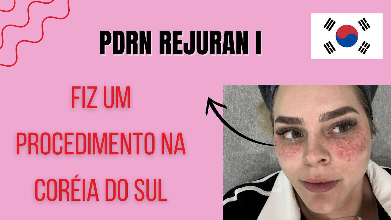 Clínica de estética na Coréia do Sul Seoul | Fiz PDRN na Coréia