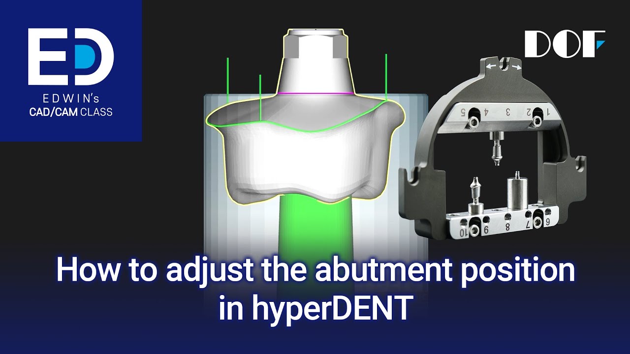 How to Adjust the Abutment Position in hyperDENT
